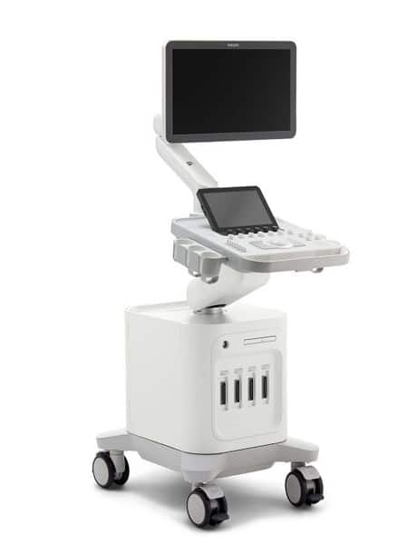 Philips-ultrasound-system-3300-general-imaging